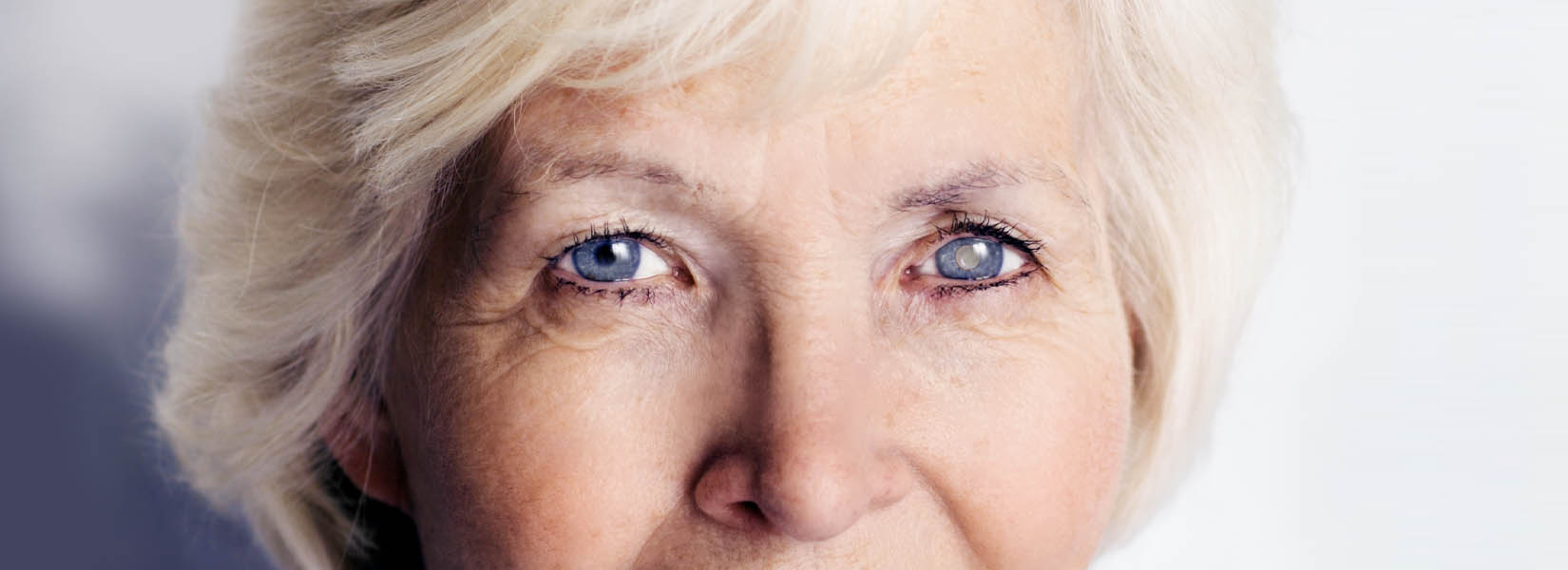 Cataract Surgery in St. Peters